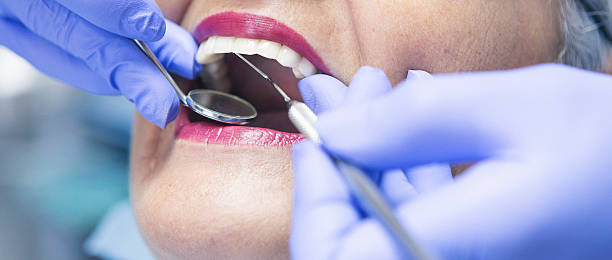 Best Emergency Tooth Extraction in Lake Linden, MI